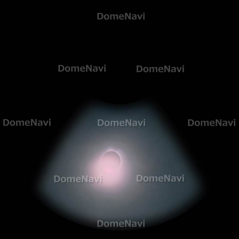 Totality in Hawaii 1991-1